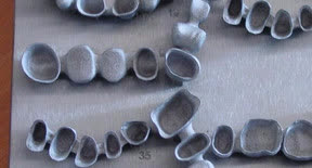 Microfusion